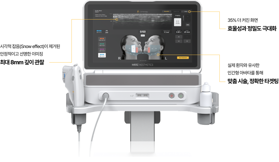 존 울쎄라보다 진화한 울쎄라피 프라임